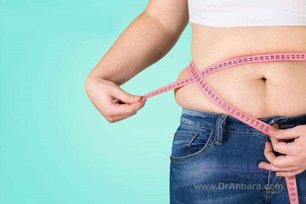 فقدان الوزن بمساعدة جراحة تحويل مجرى المعدة