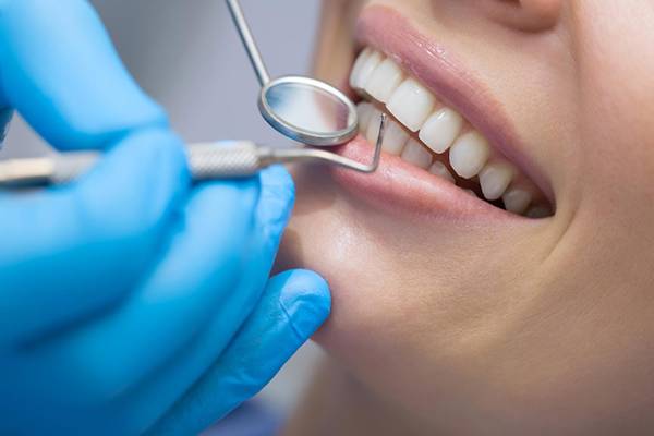 أنواع خدمات طب الأسنان
