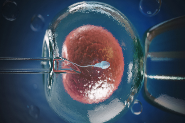 درمان ناباروری به روش IVF و مراحل آن