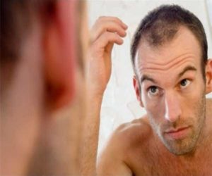 Alopecia (hair loss)