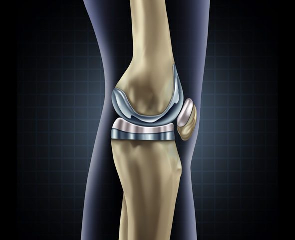 Knee replacement surgery tips
