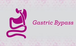 Perform Gastric Bypass Surgery