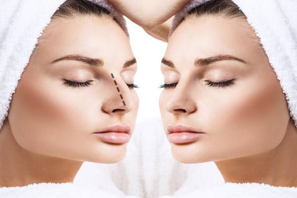 Rhinoplasty Surgery in Iran