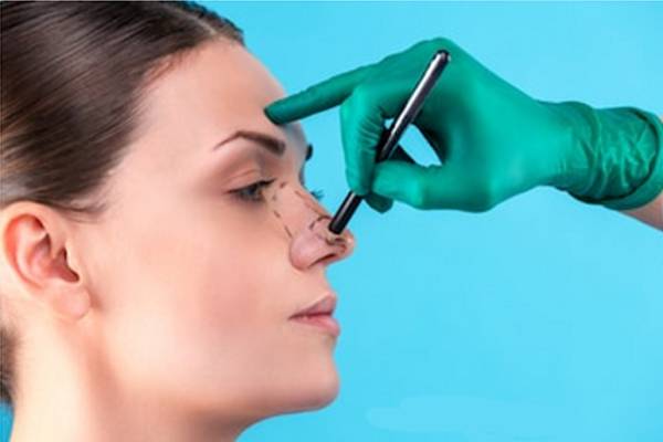 In what cases can rhinoplasty not be performed?