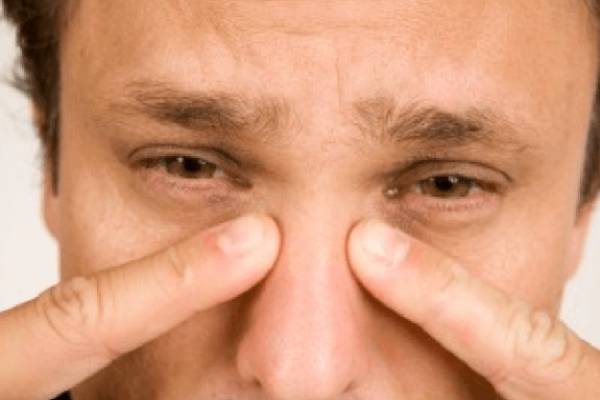 Nasal fracture and its symptoms