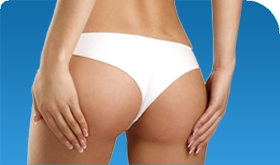 Buttock Prosthesis in Iran