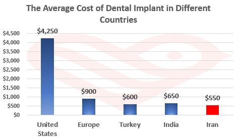 Dental Implant in Iran