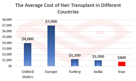 Hair Transplant in Iran