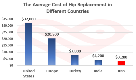 Hip Replacement in Iran