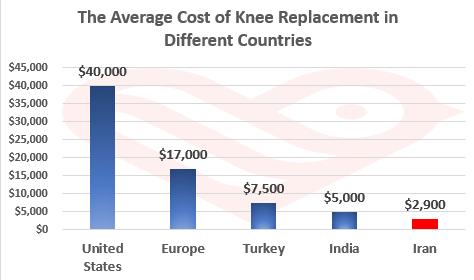 Knee Replacement in Iran