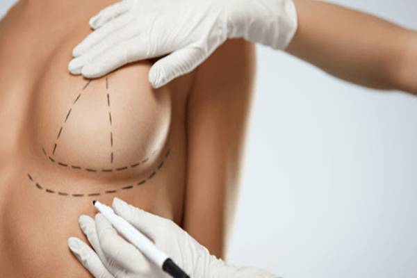 What is Breast Prostheses? Comparison of prosthetic breast