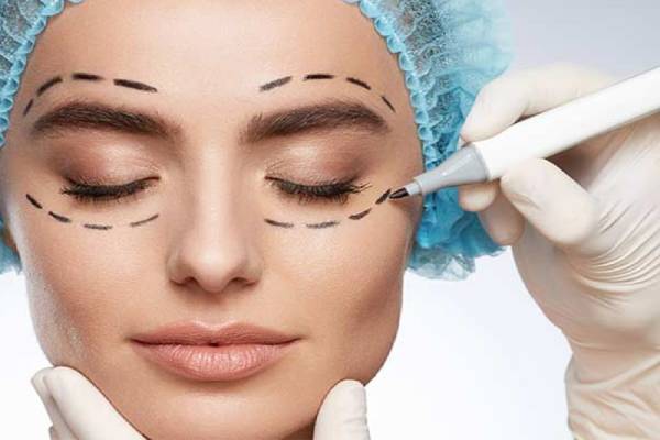 What Is Blepharoplasty