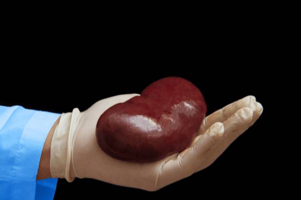 The Cost of Kidney Transplant in Iran
