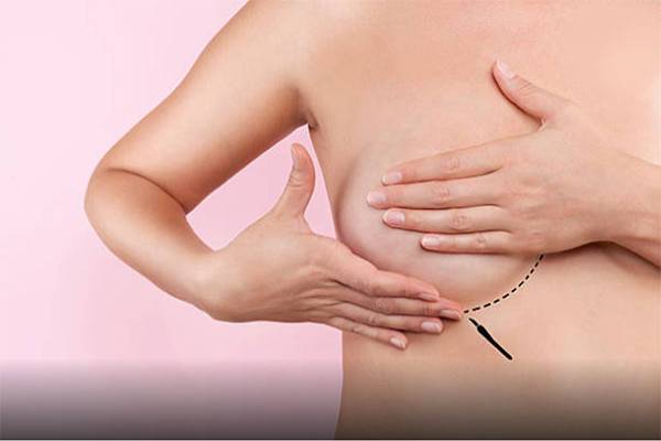 Types of Breast Prosthesis