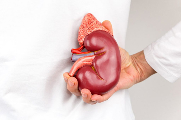 Everything About Kidney Transplantation in Iran