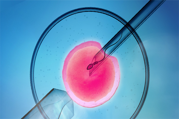 In today's world of infertility treatment, IVF is often regarded as the ultimate method of infertility treatment