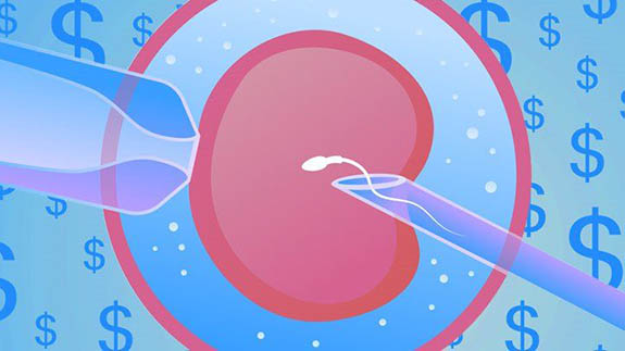 IVF Infertility Treatment in Iran