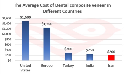 Dental composite veneer in Iran
