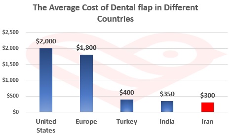 Dental Flap Surgery in Iran