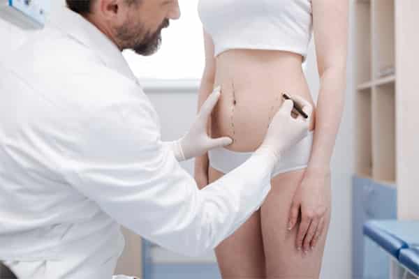 Liposuction FAQs