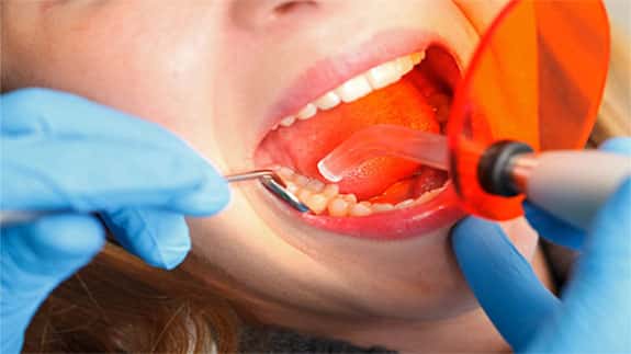 Dental restoration in Iran
